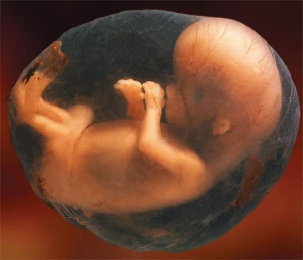 Aνάπτυξης εμβρύου 1ο τρίμηνο