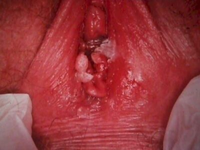 vagina1