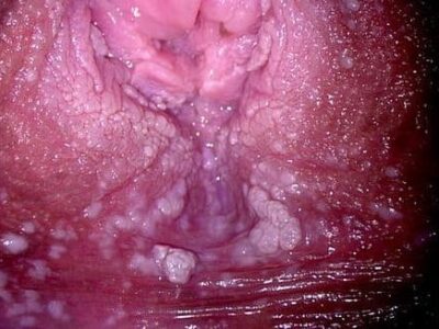 vagina3